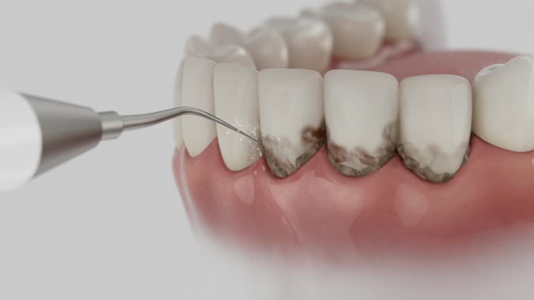 Trusted Emergency Dentist service in Mattoon, IL - Dentist Open Now